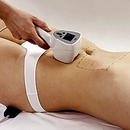 BTL Exilis Ankara